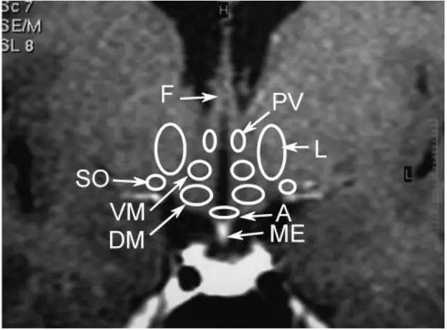 影像解剖下丘脑解剖图谱