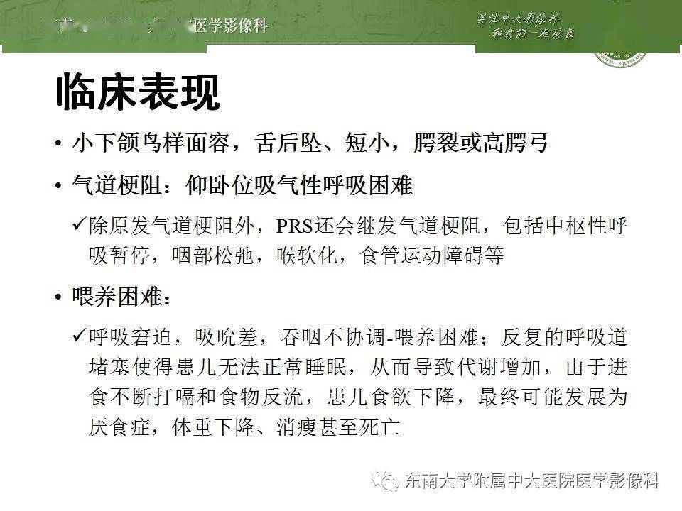 pierre robin综合征,klippel-feil综合征 头颈丨pierre-robin综合征