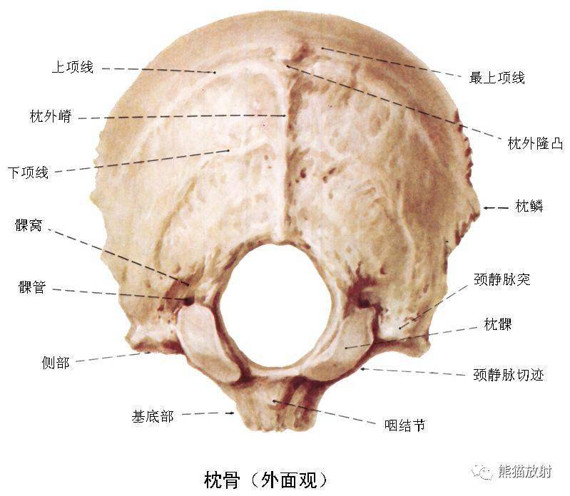 颅面颈部(颅面骨,眼眶,腮腺等)详细解剖图谱