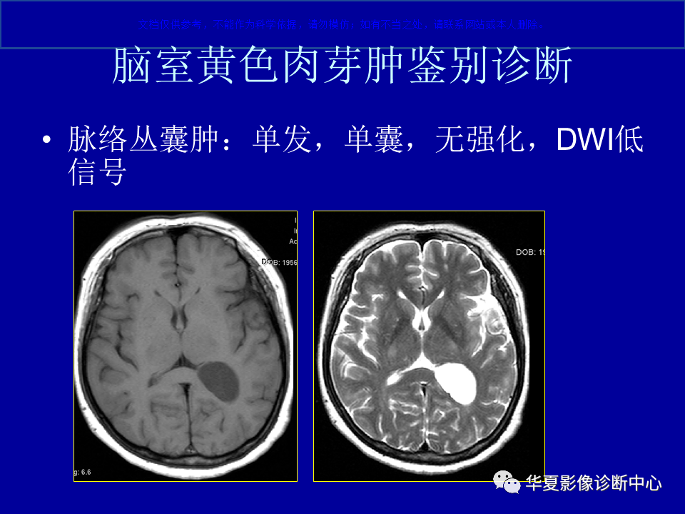 脑室脉络丛黄色肉芽肿