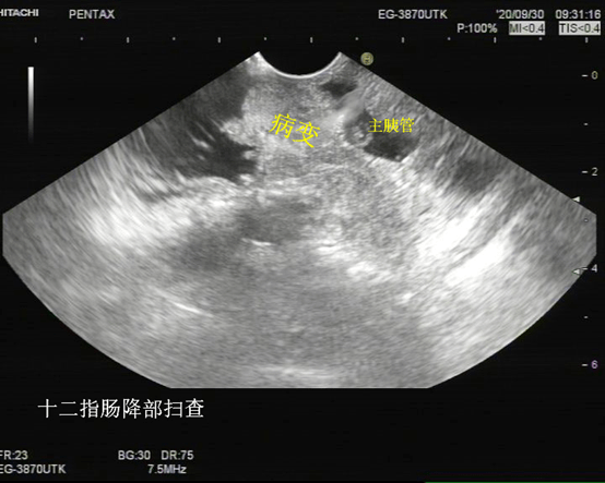 肝胆胰脏检查是什么原理_猪胰脏是什么器官图片