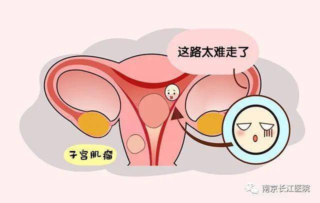 月经不调与子宫肌瘤有关系吗?