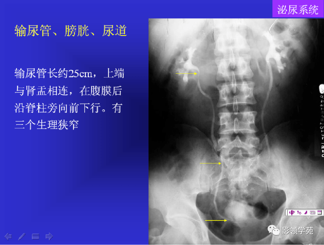 2,逆行肾盂造影(ru)最常用,可显示肾盂,肾盏,输尿管及膀胱内腔形态