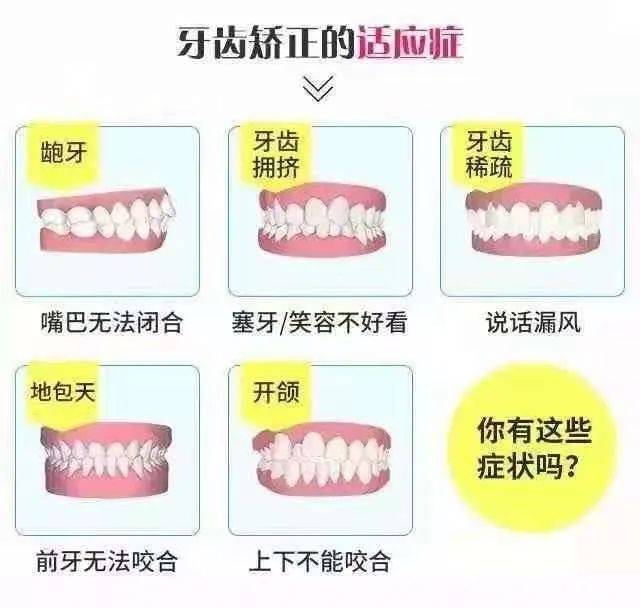 主要表现为牙齿拥挤不齐,牙齿稀疏,龅牙,地包天,露龈微笑等.