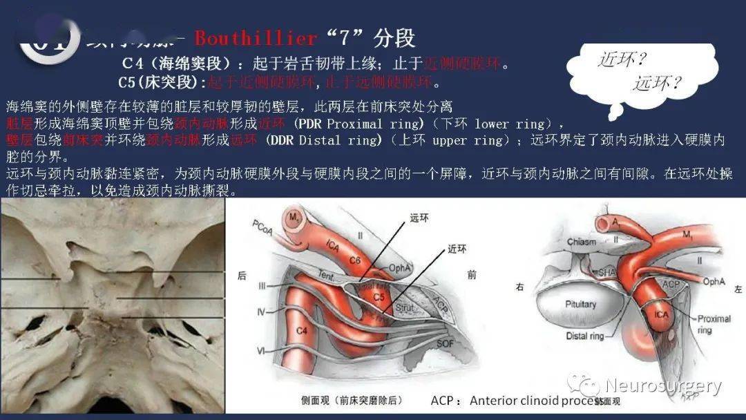 头颈动脉系统相关解剖