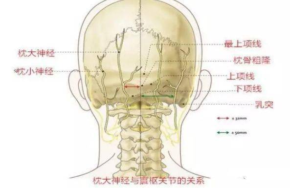 详解颈部肌筋膜性疼痛