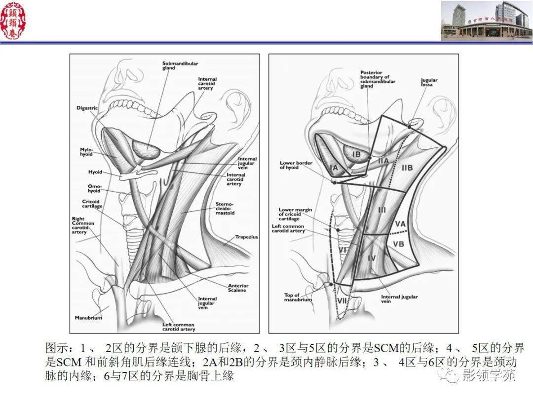 舌,口底影像解剖及常见疾病诊断