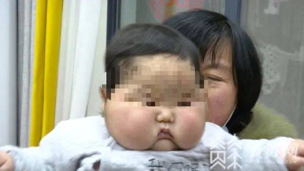 怎么才能变成大头娃娃 eac2b5d0f810464e9b3e34dd54c02886.jpeg