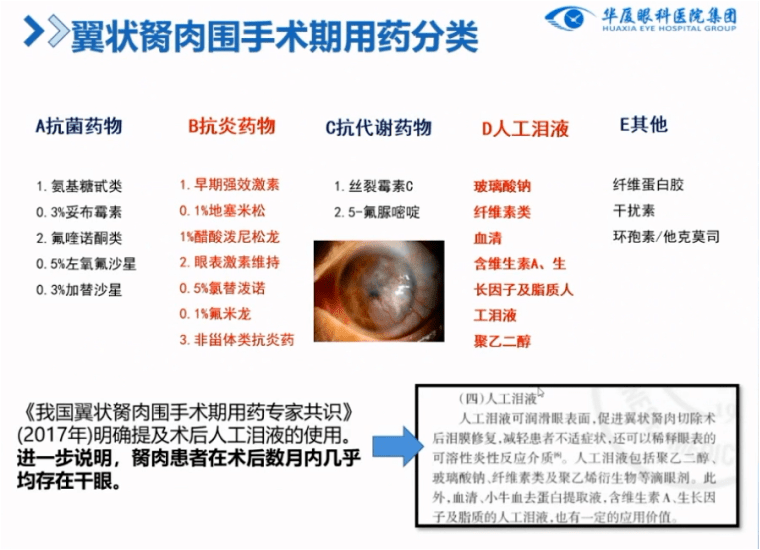 图8. 翼状胬肉围手术期用药