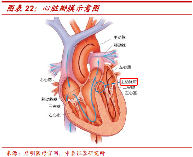 1分钟动画了解tavr黄金赛道"微创系"心脏瓣膜巨头近期上市