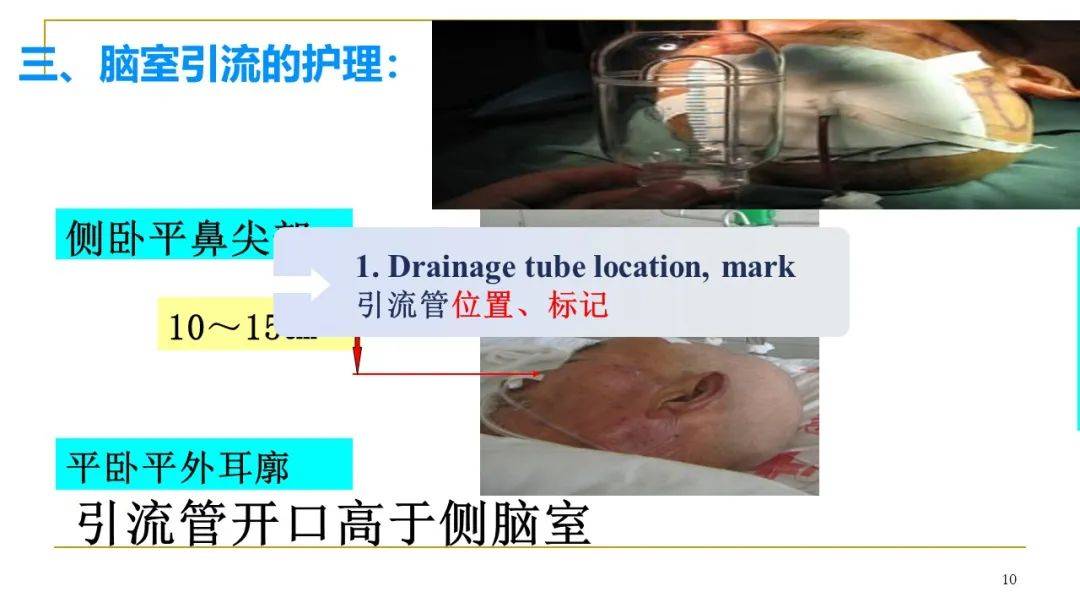 【ppt】脑室引流管的护理