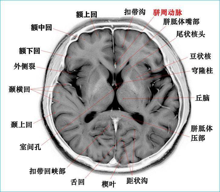 这个高清颅脑断层解剖图谱实在太棒了!【磁共振