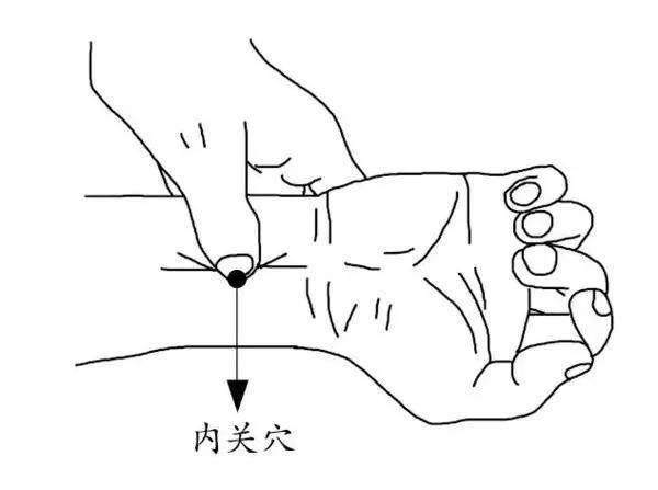 取穴:位于前臂掌侧,腕横纹上2寸,掌长肌腱与桡侧腕屈肌腱之间.