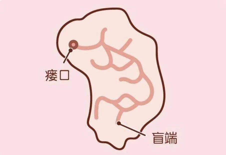 耳前瘘管为啥会感染?