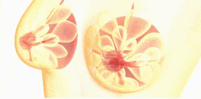 胸部下垂外扩松弛?有它1秒改善含胸驼背,隐形无痕矫正