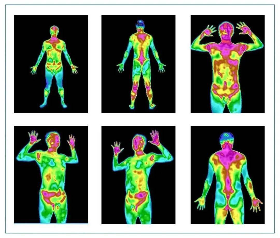 黑科技来了tmt红外热成像扫描一眼看穿你的健康状况