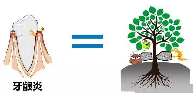 牙龈不健康的几大表现,你中招了吗?