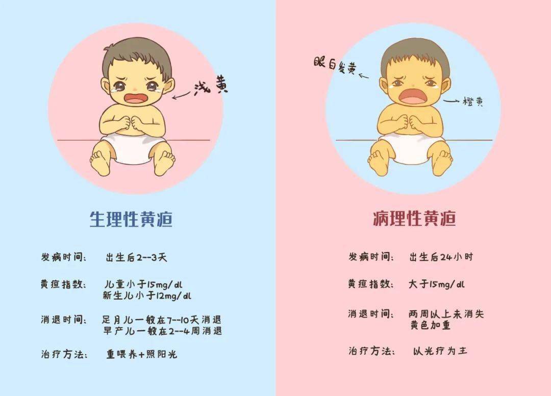 新生儿黄疸护理和治疗攻略_宝宝