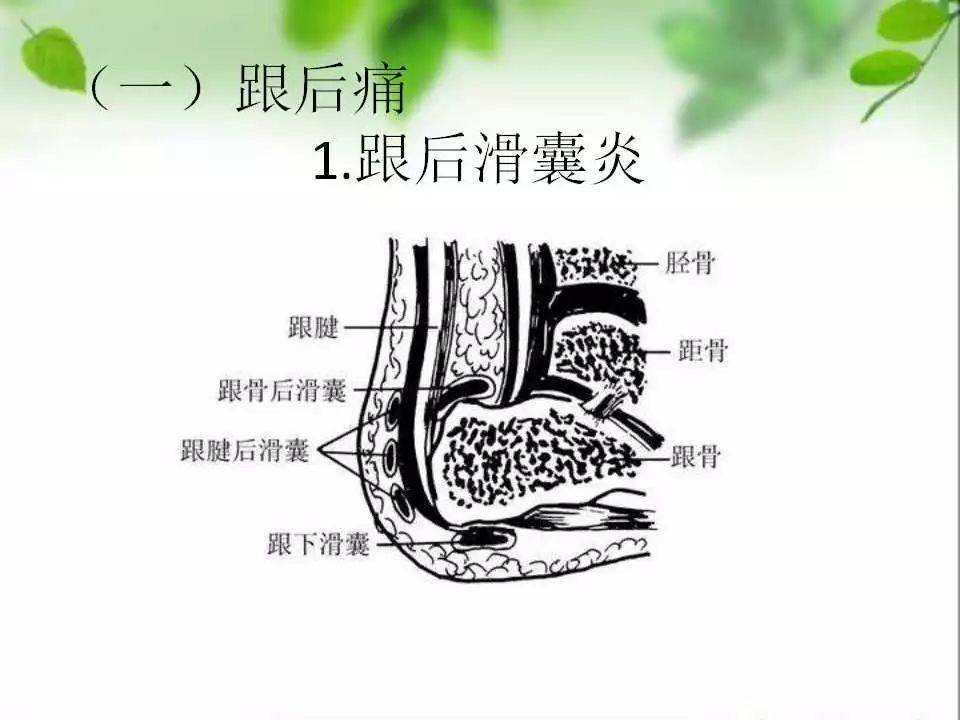 首先看一下跟后滑囊炎,足后呢共有两个滑囊,一个位于皮肤与跟腱之间