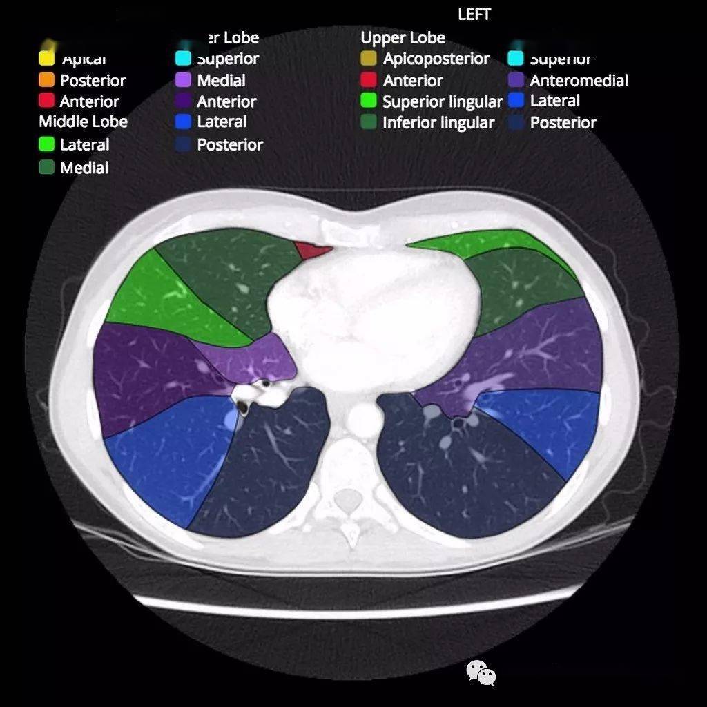 ct肺段解剖(图)