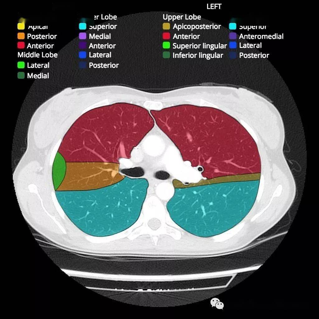 ct肺段解剖(图)