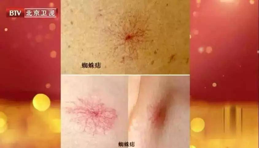 为什么有人明明看起来很瘦,却唯独肚子很大?没吓唬你!
