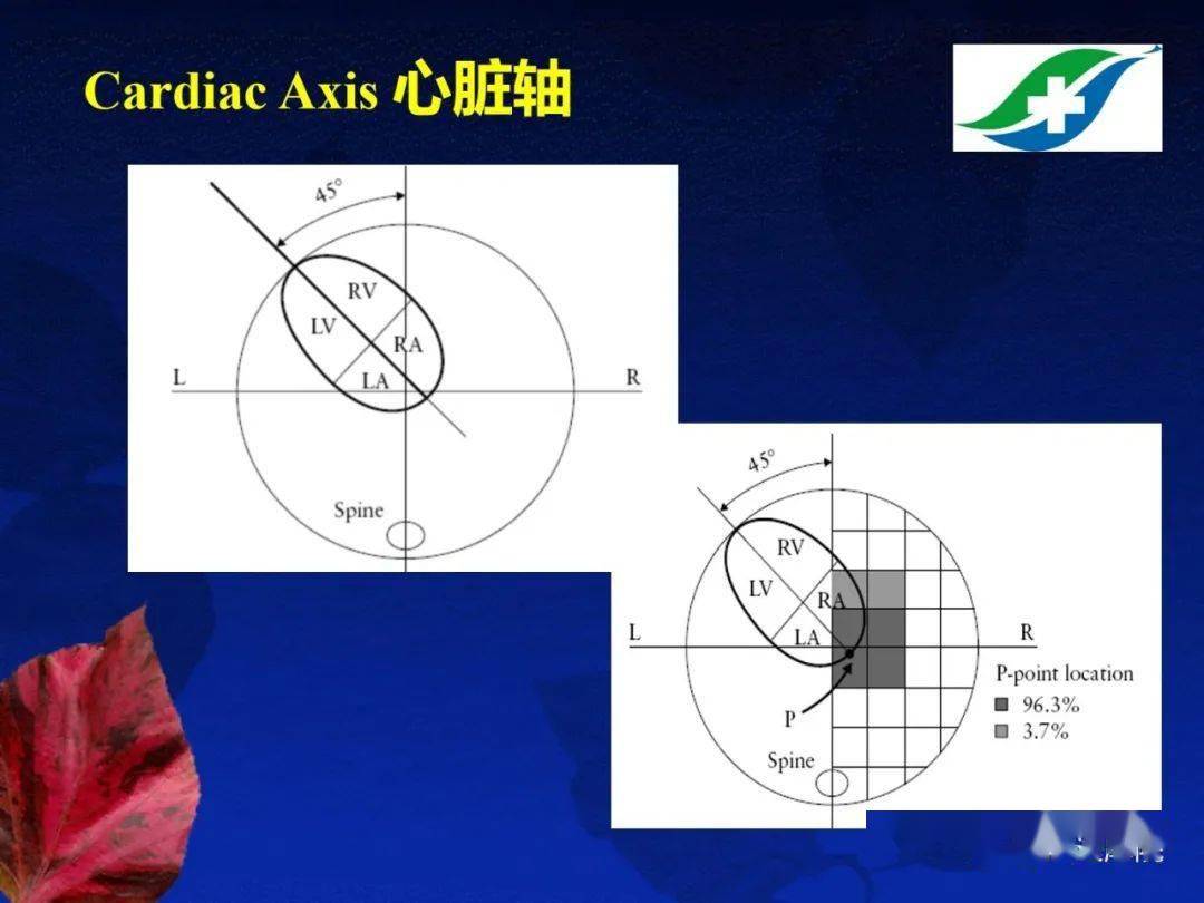 胎儿超声心动图基础及切面