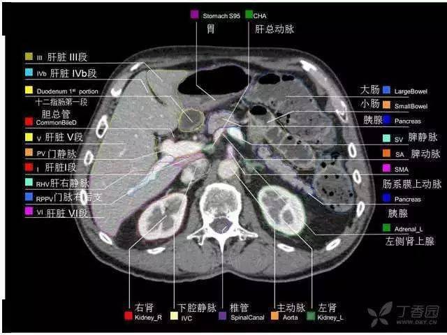 【收藏】史上最全的ct断层解剖图谱--一篇所有都有