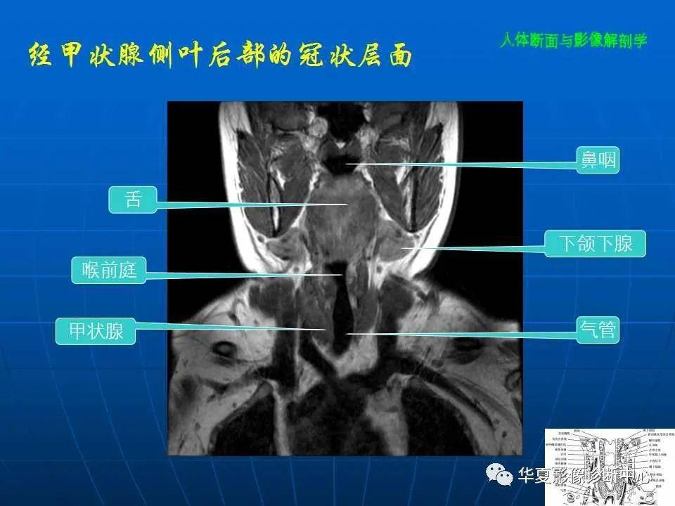 颈部影像断层解剖