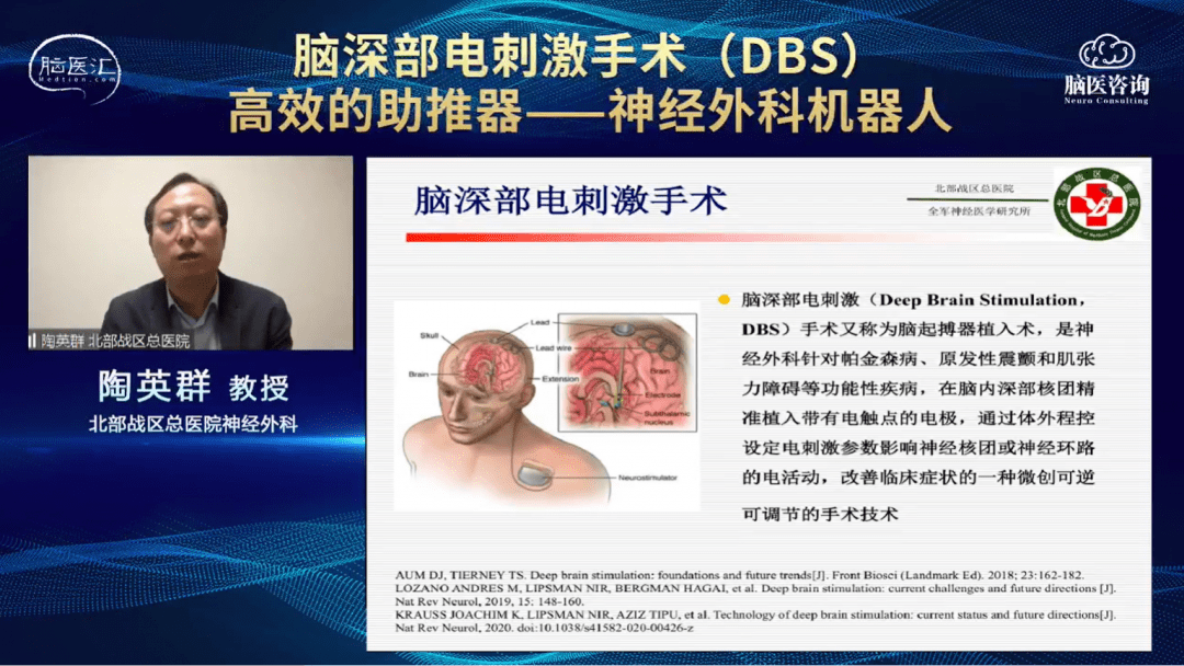 脑医咨询名家科普陶英群教授脑深部电刺激手术dbs高效的助推器神经