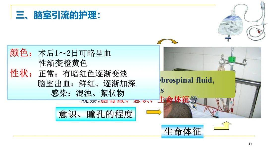【ppt】脑室引流管的护理