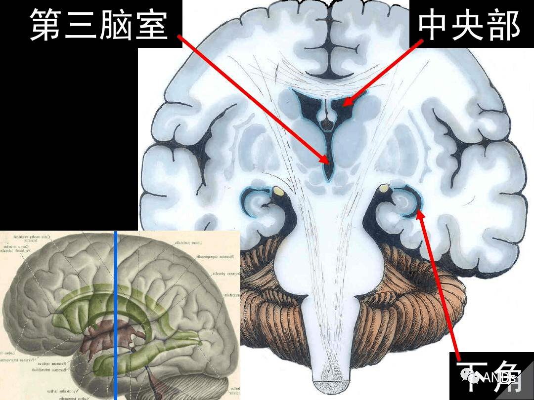 高清解剖:脑室/脑池/脑膜