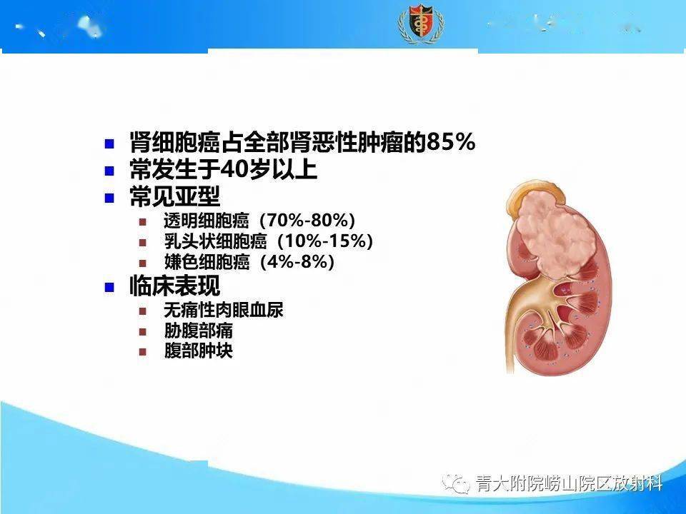 收藏丨实性肾细胞癌的影像诊断与鉴别诊断