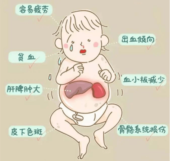 "黏宝宝——黏多糖贮积症","不食人间烟火的孩子——苯丙酮尿症","