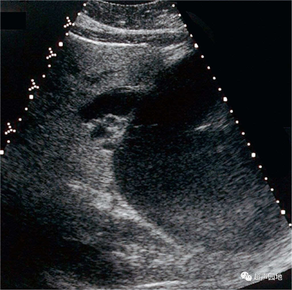 欢迎关注【超声园地,一起巩固超声基础知识!