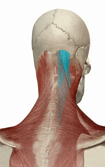 横突棘肌(多裂肌)●起点:骶骨,后上髂骨嵴,腰椎乳突,胸椎横突,颈椎