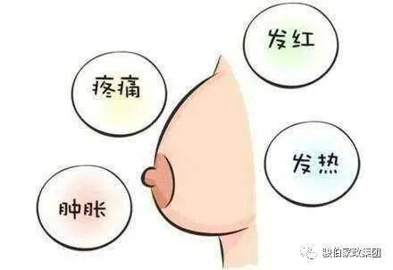 避免长时间侧卧,以免压迫乳房,影响胸部血液循环,加重涨奶情况