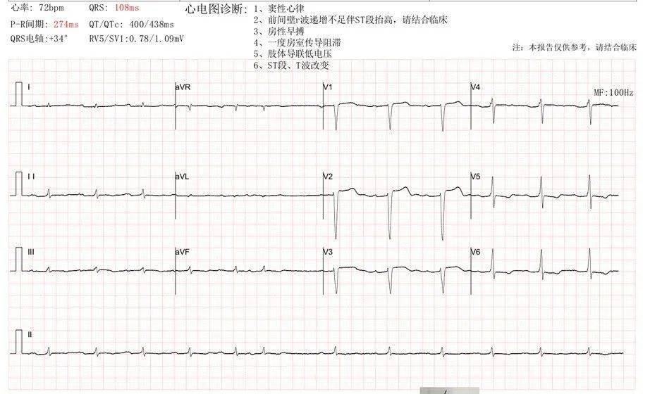 心内科医生看心脏淀粉样变