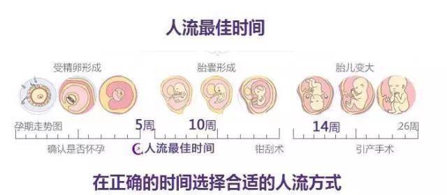 做人流的最佳时间主要是以下几个阶段