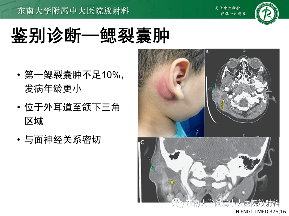 晨读结果公布20210408头颈部疾病腮腺腺淋巴瘤