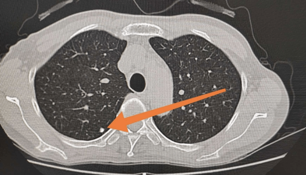 专病门诊∣肺结节与呼吸介入门诊