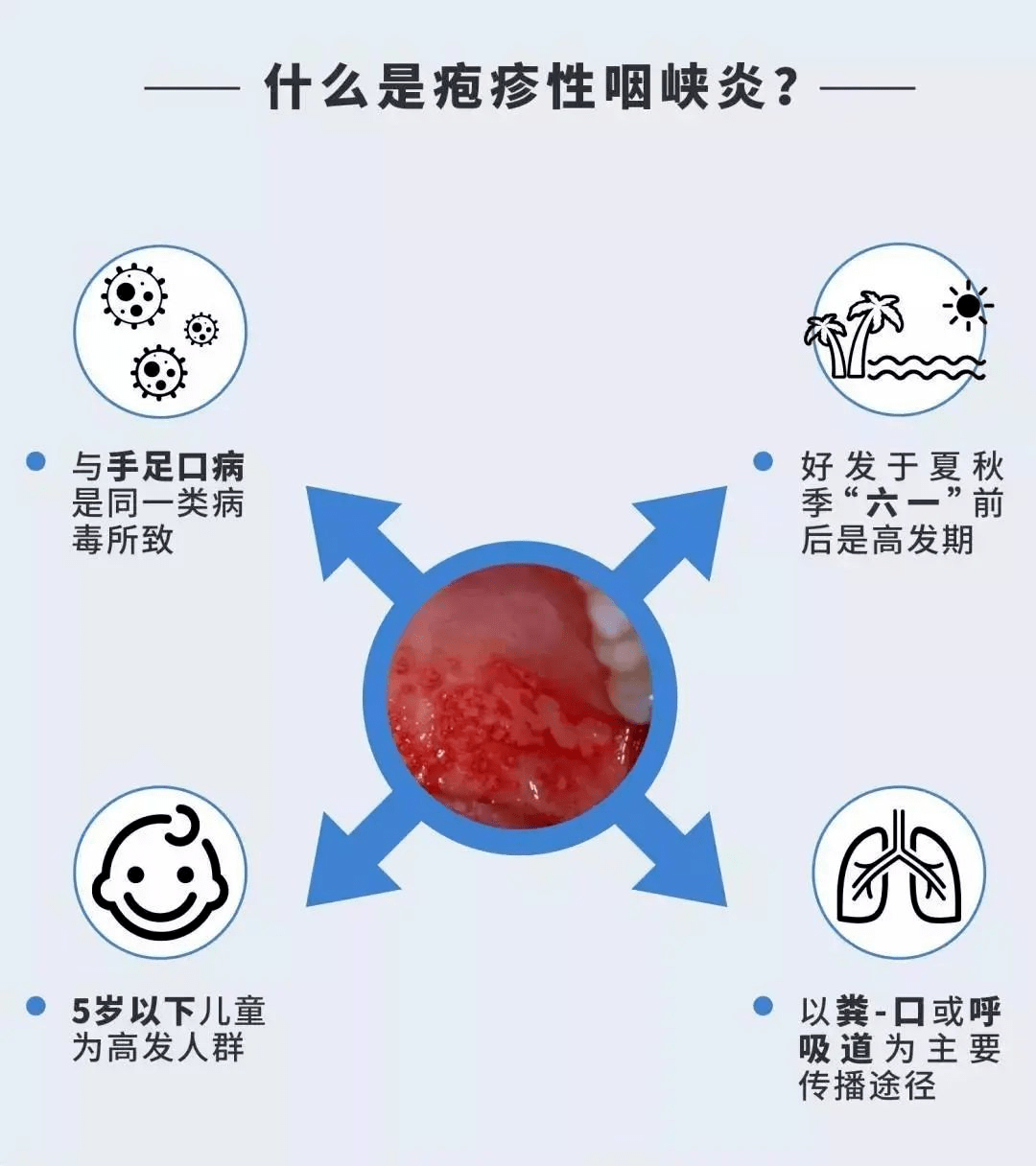 这种病进入高发,会传染!_咽峡炎