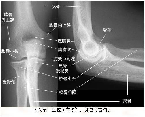 绝版收藏x线解剖