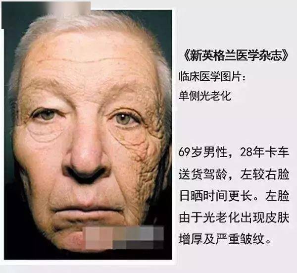 轻如苹果,小如手掌,40℃的天都晒不黑,撑上直降10度!