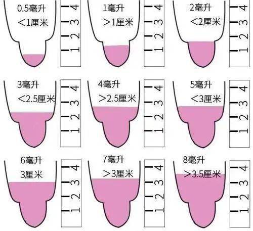 当男人的小蝌蚪出现这种状态要当心影响生育哦