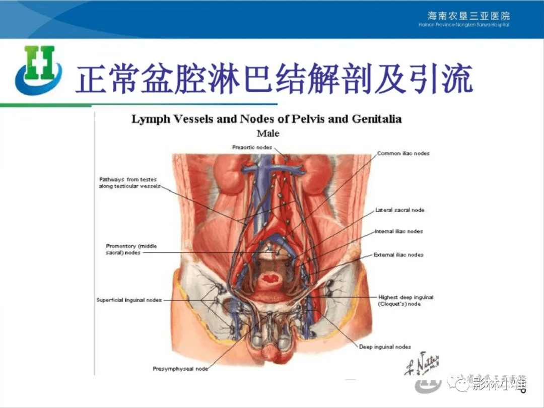 盆腔淋巴结的影像解剖及临床应用