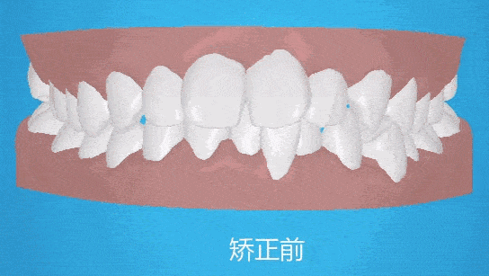 为疑难正畸病例带来治愈的希望, 好佰年口腔疑难正畸诊治中心成立