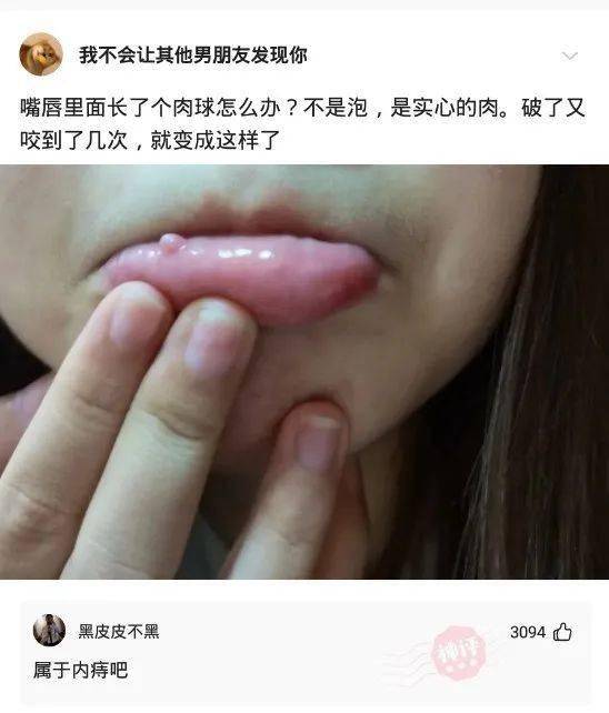 嘴唇里面长了个肉球怎么办?