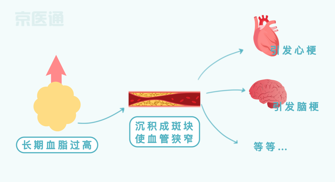 高血脂的危害