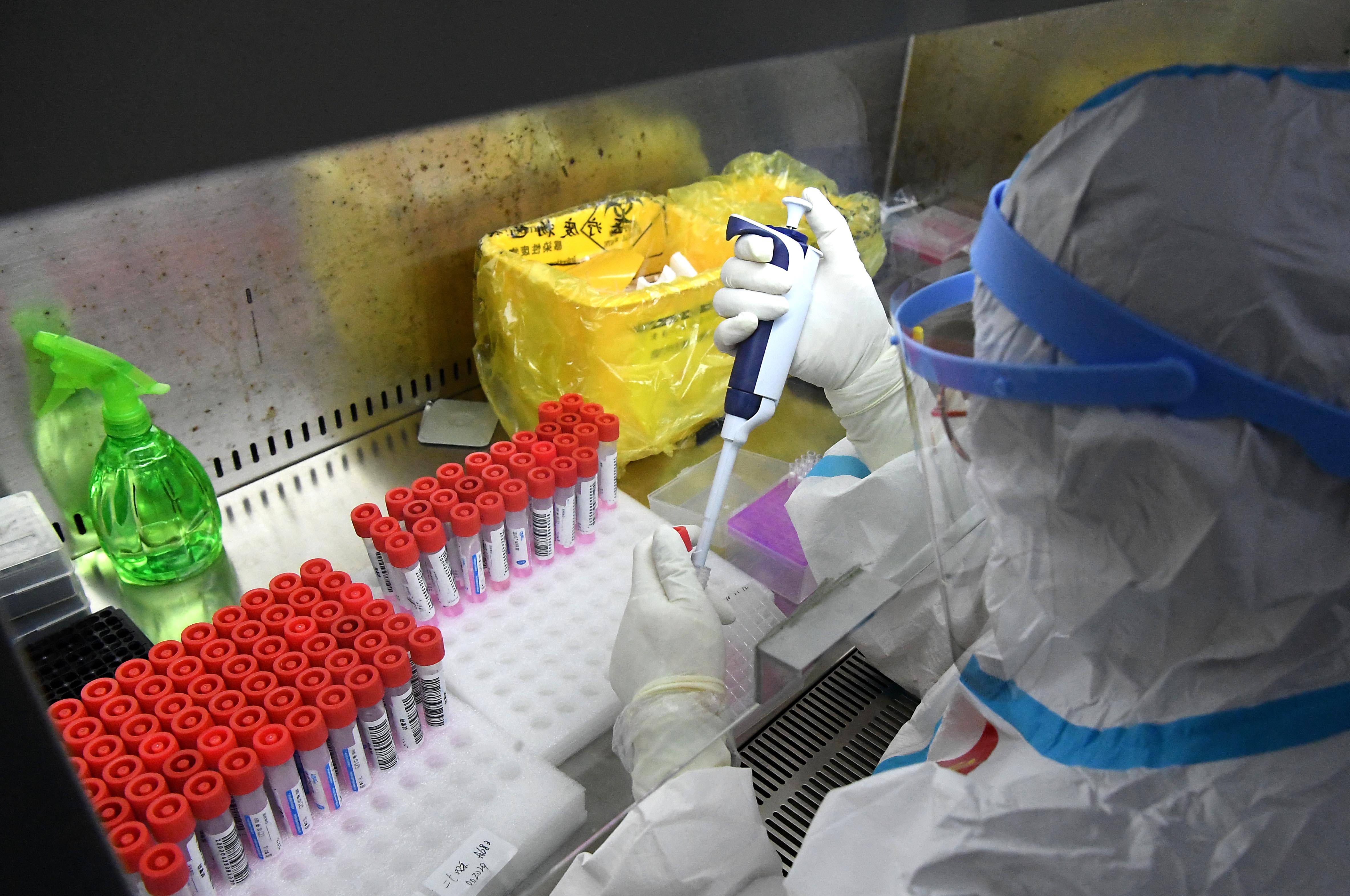 郑州走进日检200多万人份的核酸检测实验室